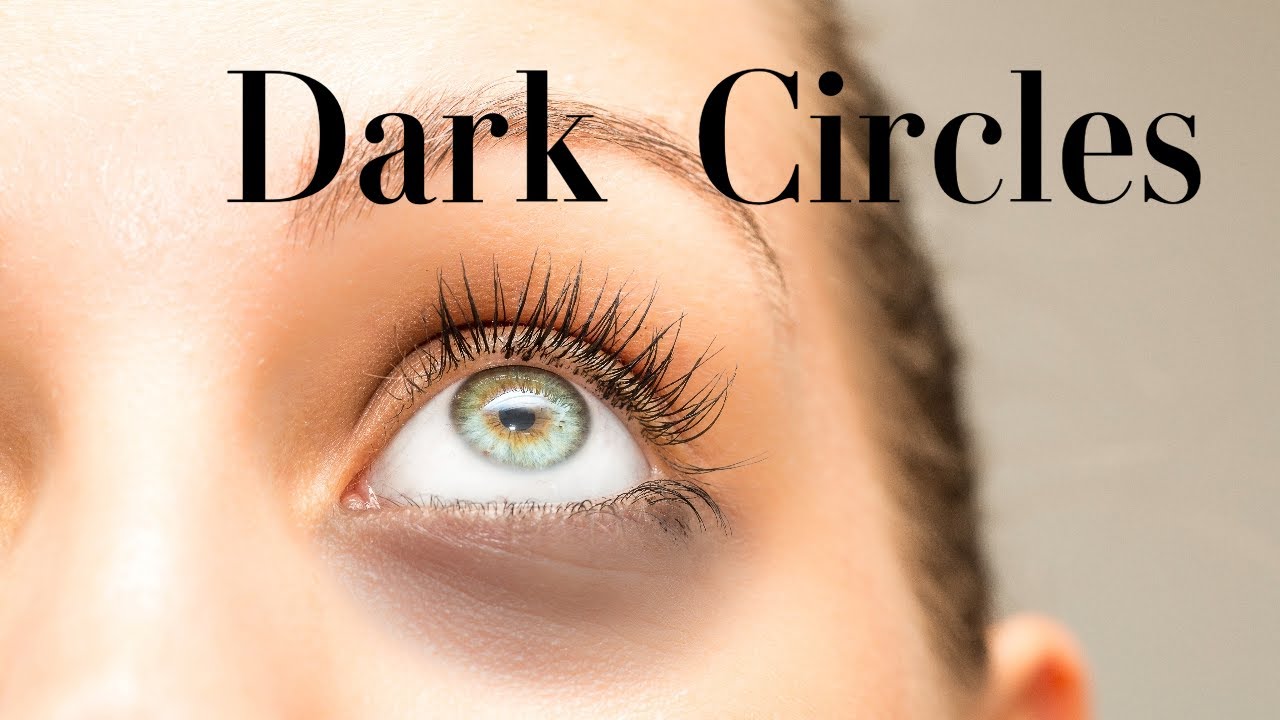 Bright Eyes: Your Ultimate Guide to Banishing Dark Circles Naturally video thumbnail